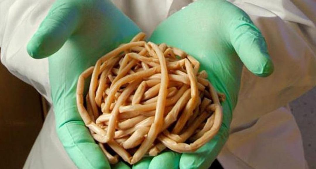 &Ouml;ld&uuml;ren moda! Tenya hapı i&ccedil;ende var, deterjan kullanan da