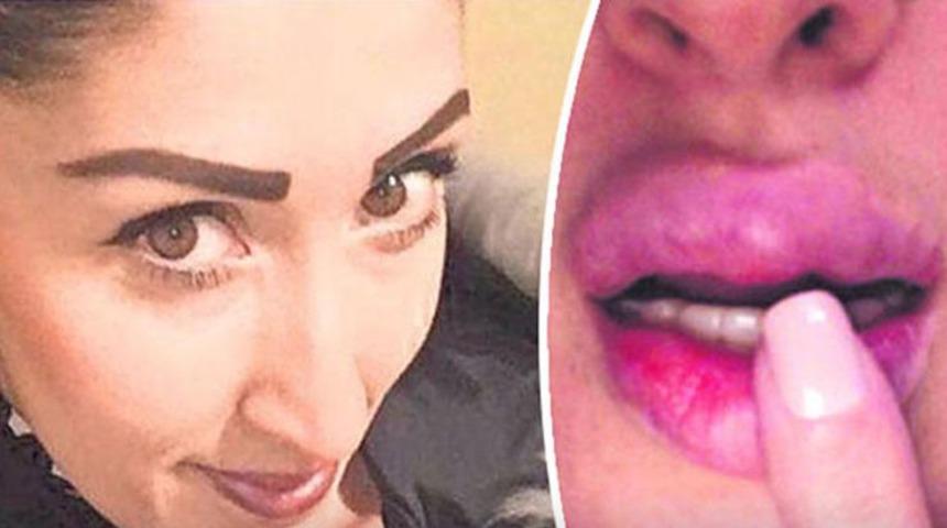 İzmir'de estetik faciası! 