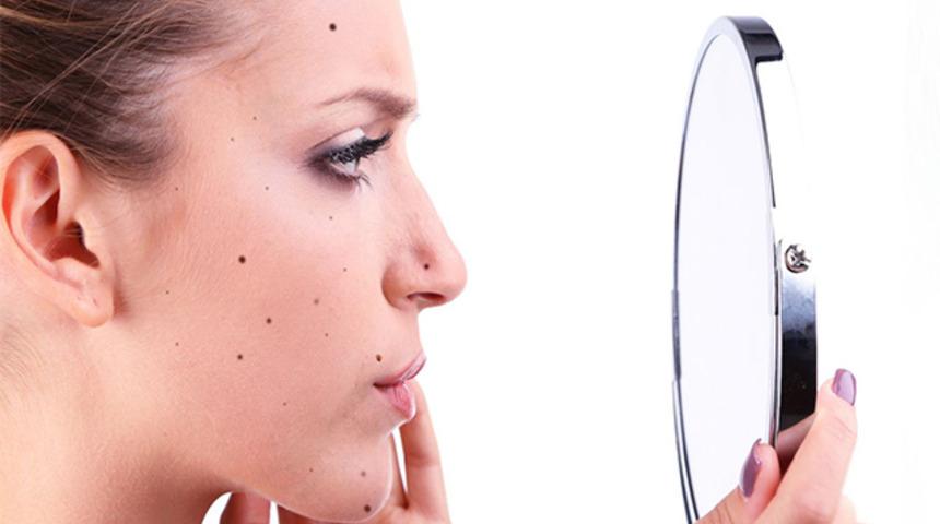 V&uuml;cuttaki benler masum olmayabilir! Sizin beniniz bunlardan biri mi?