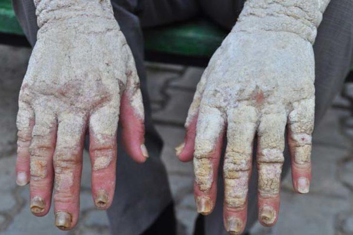  İnsanlar korkudan yanına dahi yaklaşamıyordu! Sonuca  akrabaları bile şaşıp kaldı G1