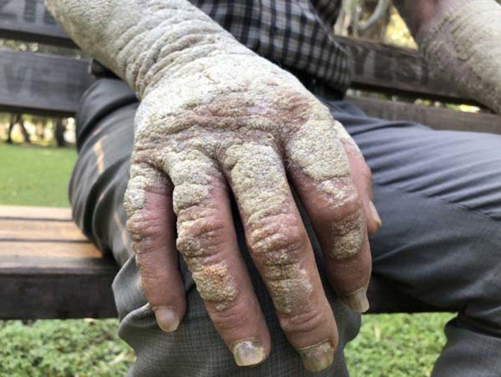  İnsanlar korkudan yanına dahi yaklaşamıyordu! Sonuca  akrabaları bile şaşıp kaldı G2