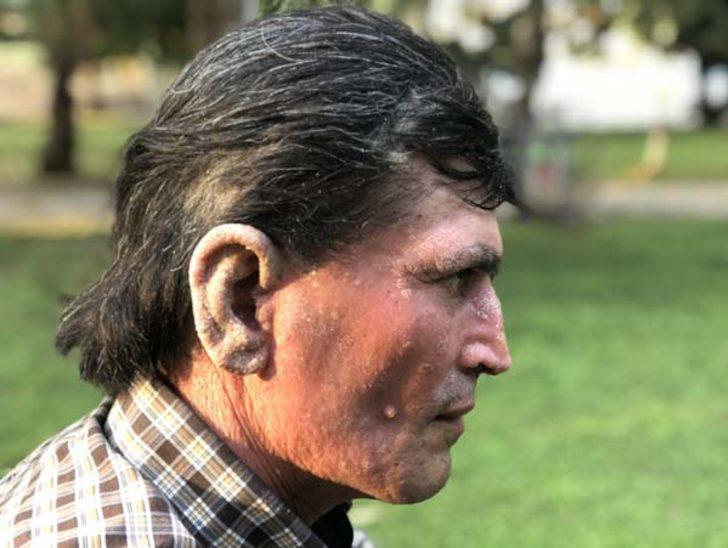  İnsanlar korkudan yanına dahi yaklaşamıyordu! Sonuca  akrabaları bile şaşıp kaldı G3