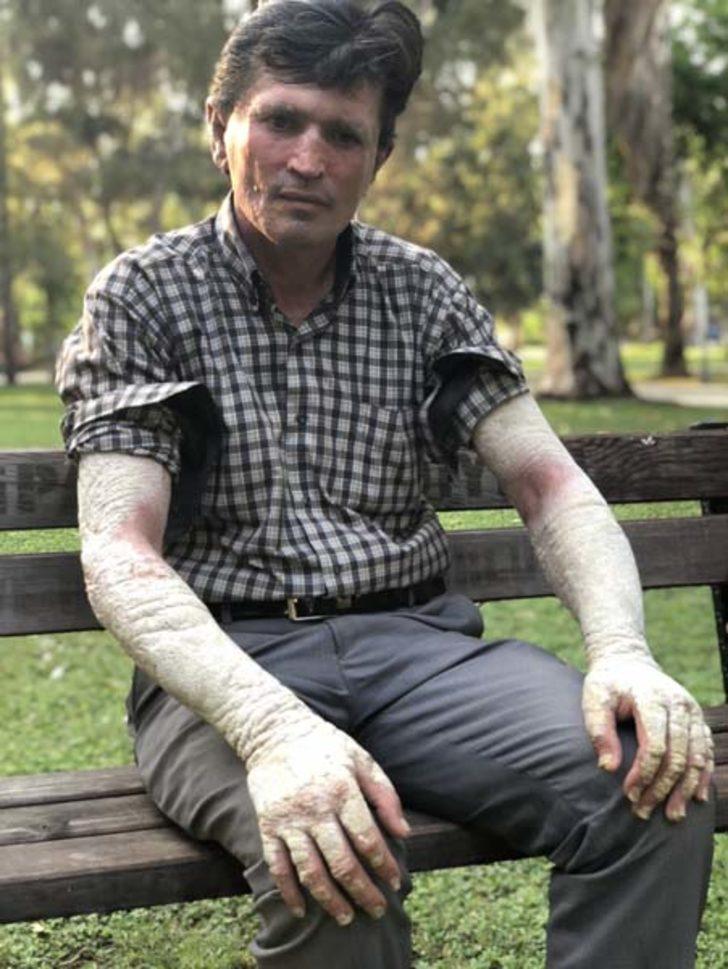  İnsanlar korkudan yanına dahi yaklaşamıyordu! Sonuca  akrabaları bile şaşıp kaldı G4