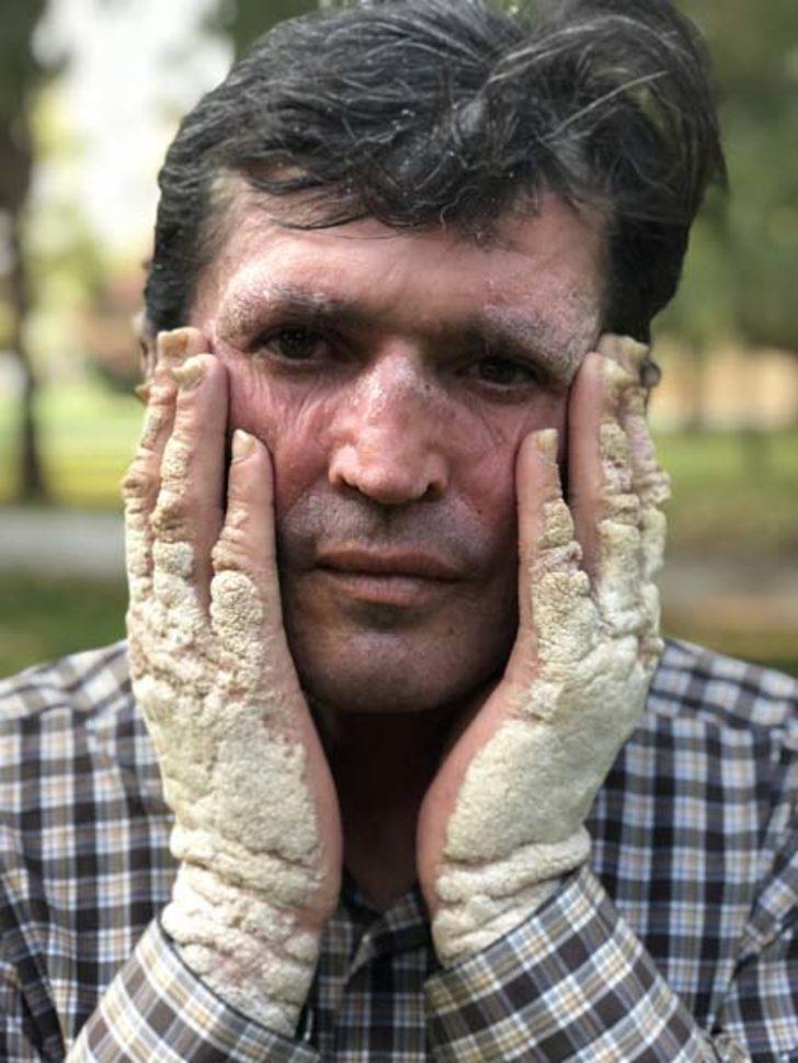  İnsanlar korkudan yanına dahi yaklaşamıyordu! Sonuca  akrabaları bile şaşıp kaldı G5