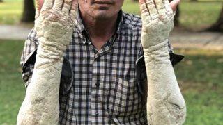  İnsanlar korkudan yanına dahi yaklaşamıyordu! Sonuca  akrabaları bile şaşıp kaldı