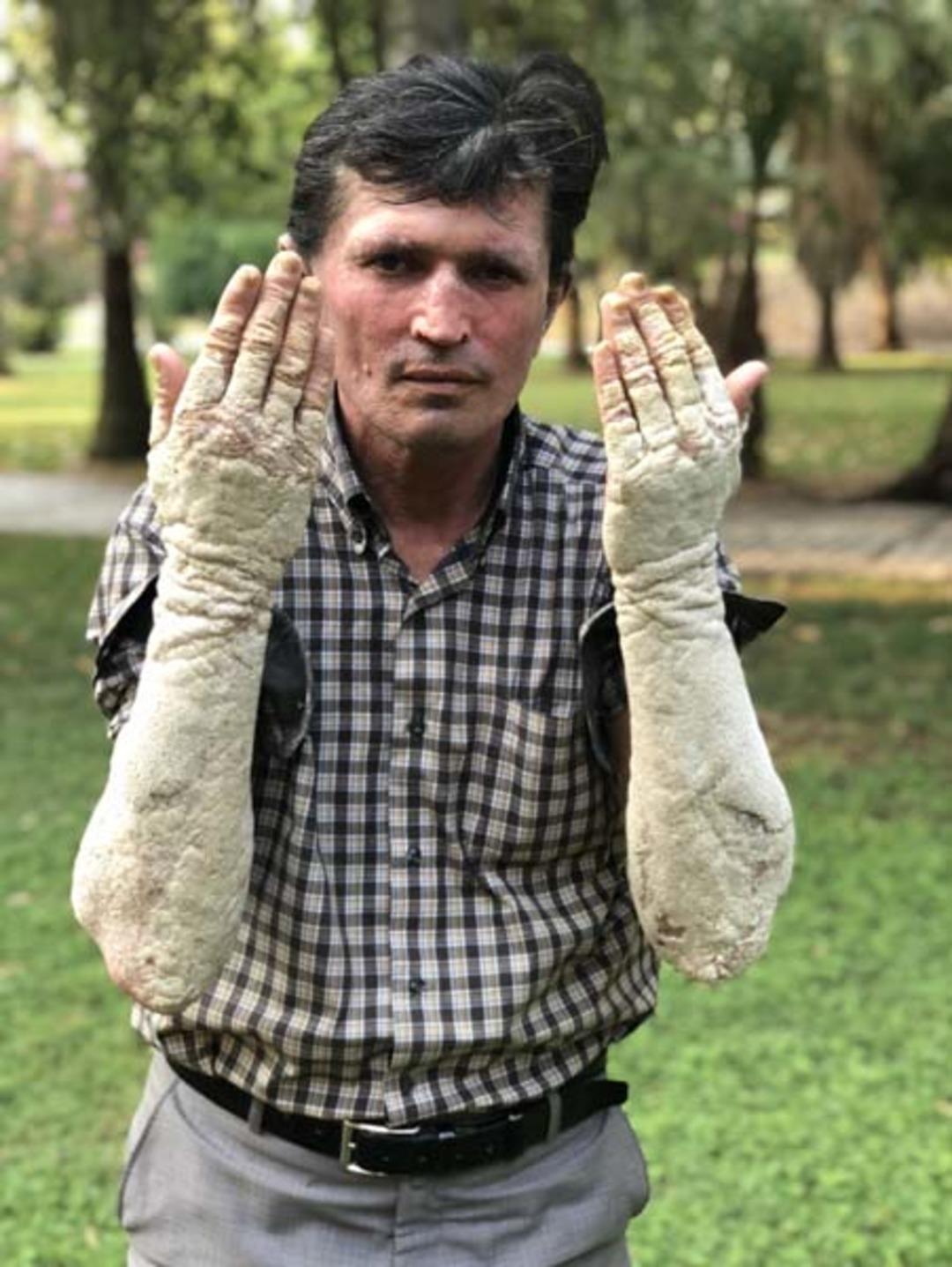  İnsanlar korkudan yanına dahi yaklaşamıyordu! Sonuca  akrabaları bile şaşıp kaldı