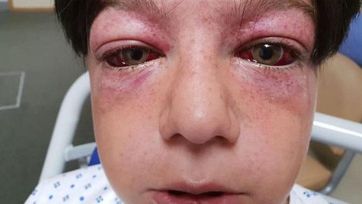 Doktorlar bile anlamadı, başına sadece astronotların yaşadığı bir olay geldi G1