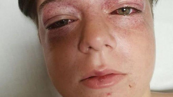 Doktorlar bile anlamadı, başına sadece astronotların yaşadığı bir olay geldi G2