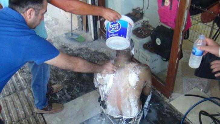 Şanlıurfa'da milletvekillerinden iş isteyen bir genç kendini yaktı G3