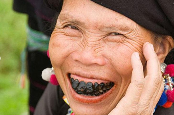 Cinsel organlarına deterjan sürüp öldüler!  G4