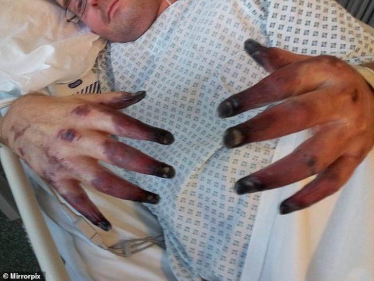 Elleri ve ayakları birden karardı! Dikkat! Sizin de başınıza gelebilir G2