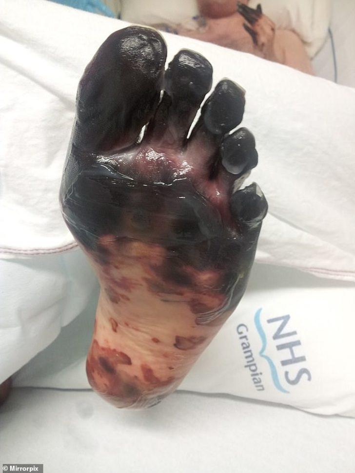 Elleri ve ayakları birden karardı! Dikkat! Sizin de başınıza gelebilir G4