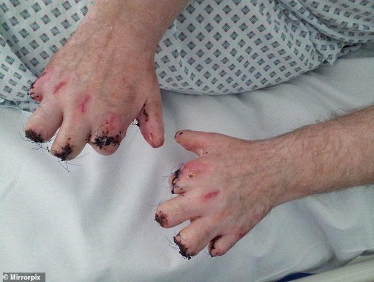 Elleri ve ayakları birden karardı! Dikkat! Sizin de başınıza gelebilir G5