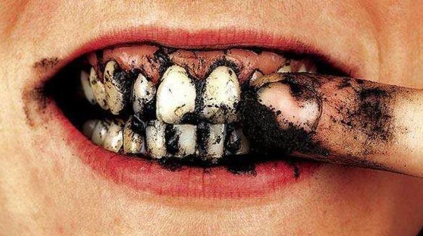 Dişte oluşan sigara ve kahve lekeleri nasıl yok edilir?