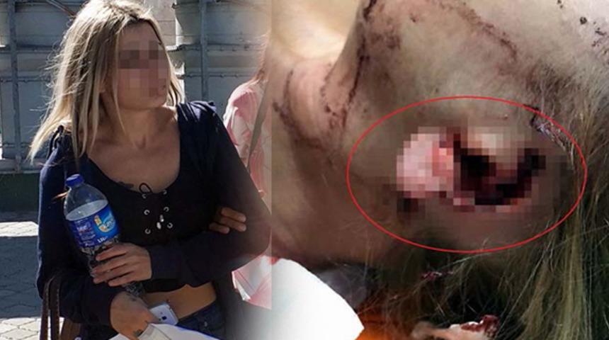 Samsun'da kadınların bar kavgası kanlı bitti! Arkadaşının kulağını kopardı!