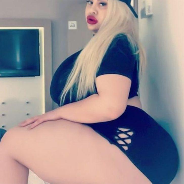 En büyük kalçaya sahip olmak istedi ama...  G1