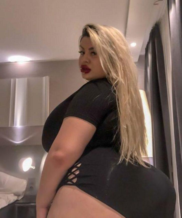 En büyük kalçaya sahip olmak istedi ama...  G2