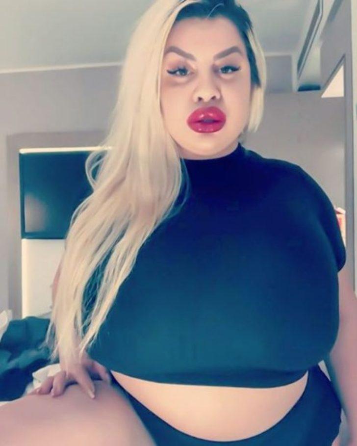 En büyük kalçaya sahip olmak istedi ama...  G3