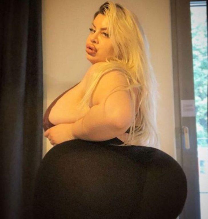 En büyük kalçaya sahip olmak istedi ama...  G4