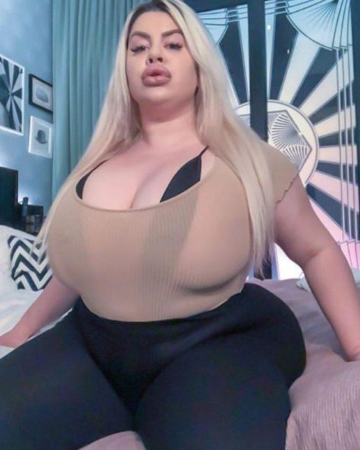 En büyük kalçaya sahip olmak istedi ama...  G5