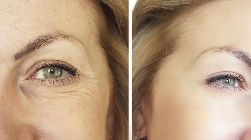 Ajda Pekkan'a meydan okutur: Yaşlanmayı yavaşlatan kollajen bakımından zengin 10 gıda