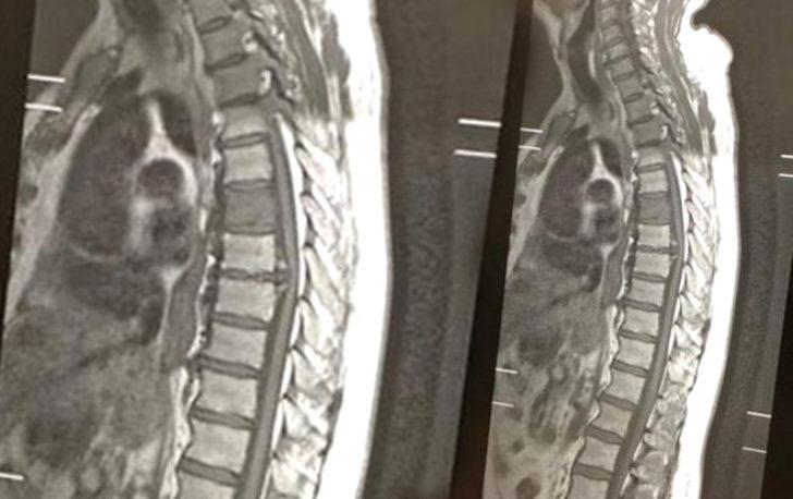 70 yaşındaki adamın içinden köpek çıktı G1