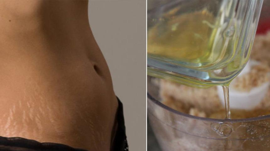 Neye iyi gelmiyorlar ki! Göbek eritmeden öksürük kesmeye kadar etkili 8 kür tarifi