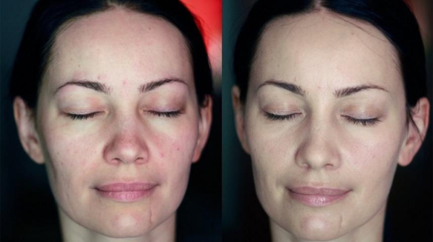 BB,CC, DD, EE, PP Kremler Nedir? Farkları Ne? 