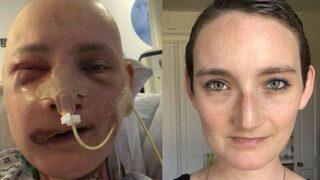 'Yüz rekonstrüksiyon ameliyatı hayatımı değiştirdi'