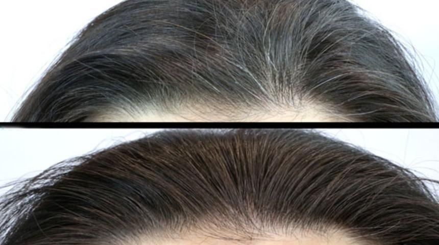 Doğal yolu varmış! Sa&ccedil; beyazlamasına &ccedil;&ouml;z&uuml;m &ouml;nerileri