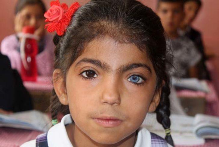 Gözlerini gören şaşkına dönüyor!  G5