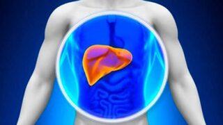 Karaciğer yağlanmasının sebepleri nelerdir? Karaciğer yağlanması neden olur? Karaciğer yağlanması tedavisi 