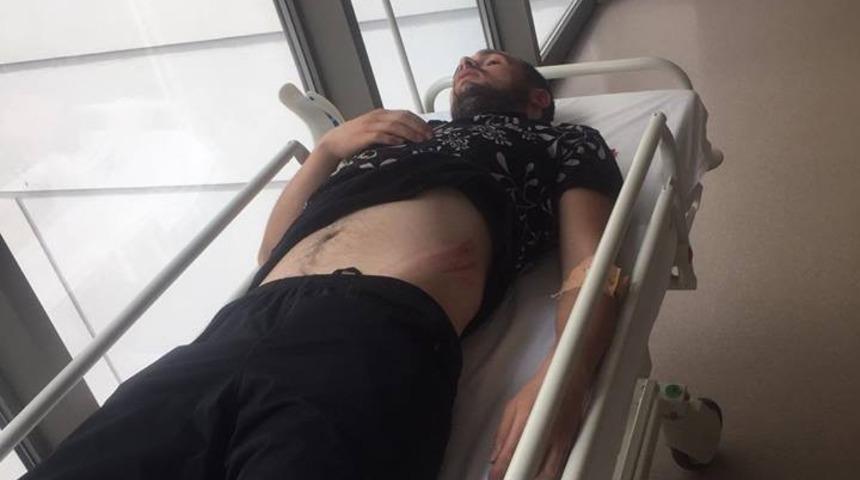 Maç sonrası çıkan kavga futbolcuyu yoğun bakıma soktu