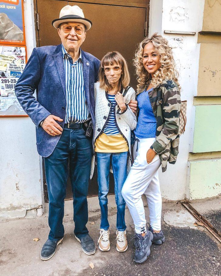 Tedavi olmazsa ölecek! Sadece elma ve muzla beslenerek 17 kiloya düştü G3