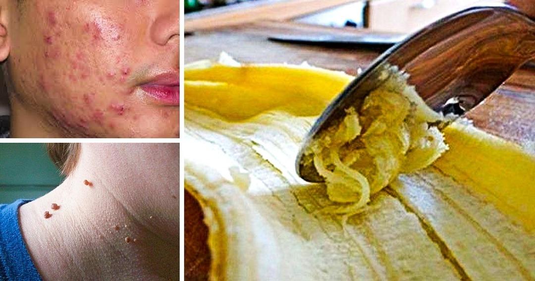 Cilt sağlığı i&ccedil;in dikkat edilmesi gerekenler! Bazı hataları &ccedil;ok sık yapıyoruz