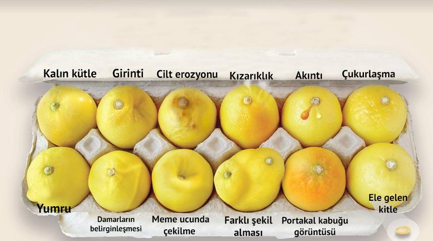 Limonlu teşhis! Bu fotoğrafla kanser olduğunu &ouml;ğrendi