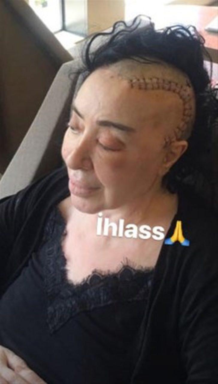 Nur Yerlitaş sağlığına kavuştu! İşte son hali...  G5