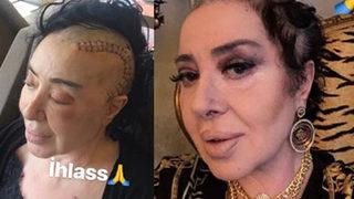 Nur Yerlitaş sağlığına kavuştu! İşte son hali... 