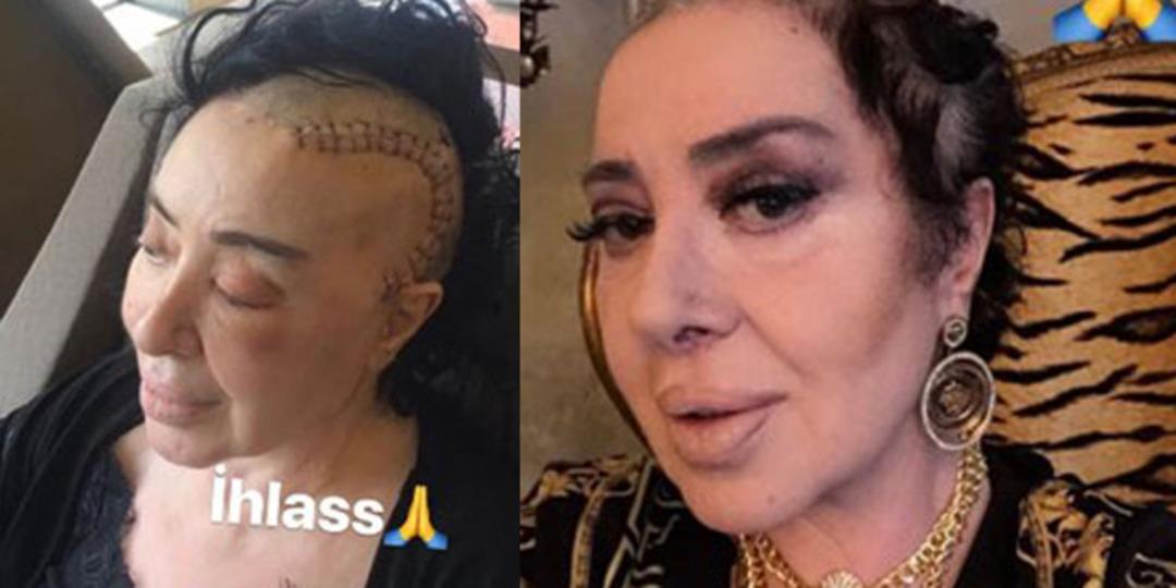 Nur Yerlitaş sağlığına kavuştu! İşte son hali... 