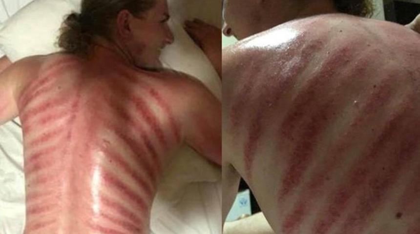 Kızıl Ejder masajı bu hale getirdi