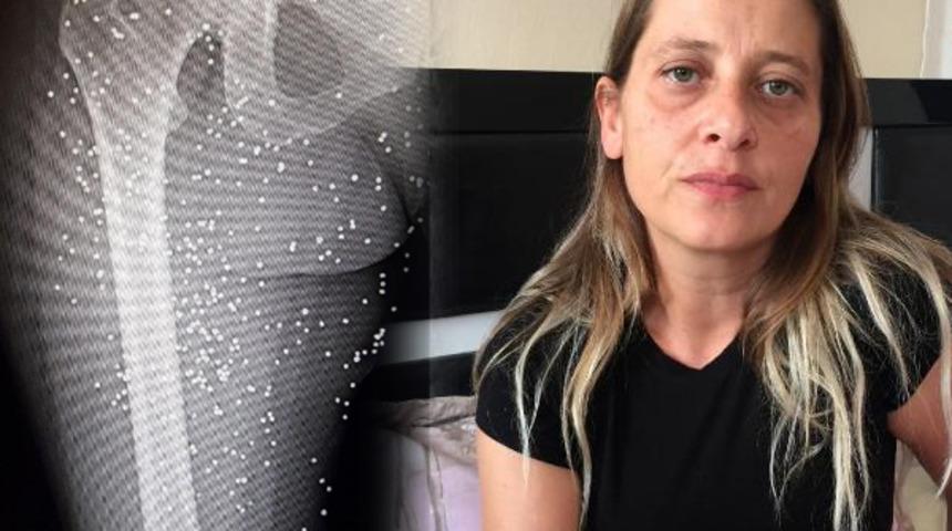 V&uuml;cudunda tam 600 tane sa&ccedil;mayla yaşamak zorunda!