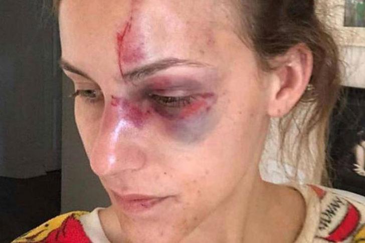 Vahşetin böylesi! Genç kızın dekoltesini abartılı bulunca... G2