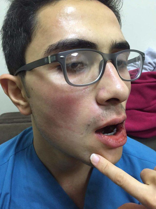 Acil serviste sağlık çalışanına yumruklu saldırı 1