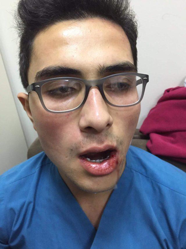 Acil serviste sağlık çalışanına yumruklu saldırı 2