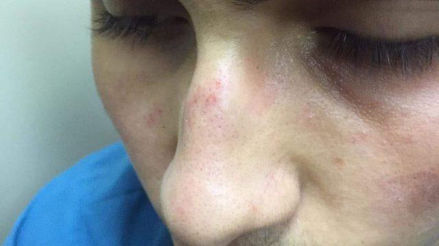 Acil serviste sağlık çalışanına yumruklu saldırı