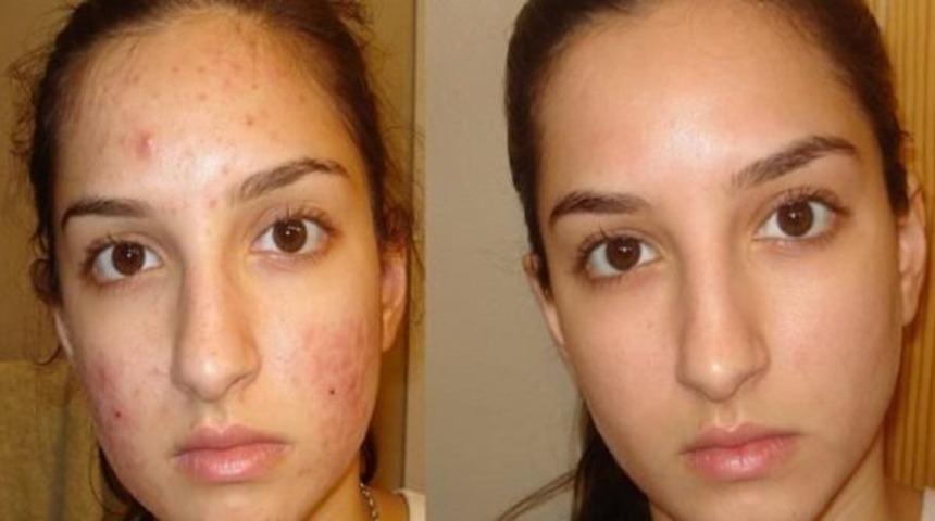 Bebek gibi bir cilde sahip olmak için uygulanacak 8 yöntem