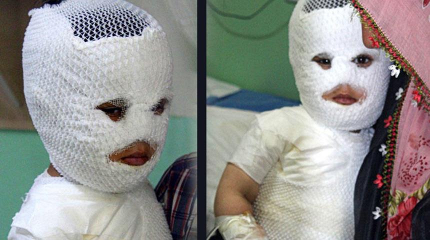 Doğu Anadolu'da facia! 400 kişi böyle yandı