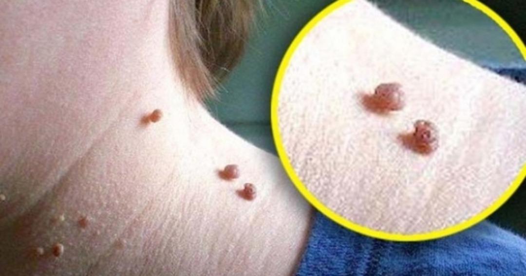 Et benlerini patır patır d&ouml;kecek 5 tarif