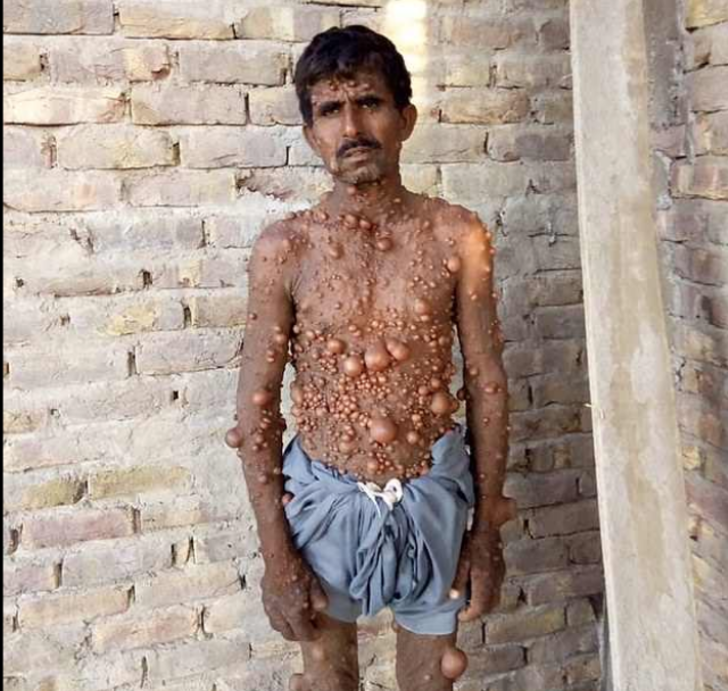 Onu gören yolunu değiştiriyor: 'Ailemi utandırmamak için...' G1