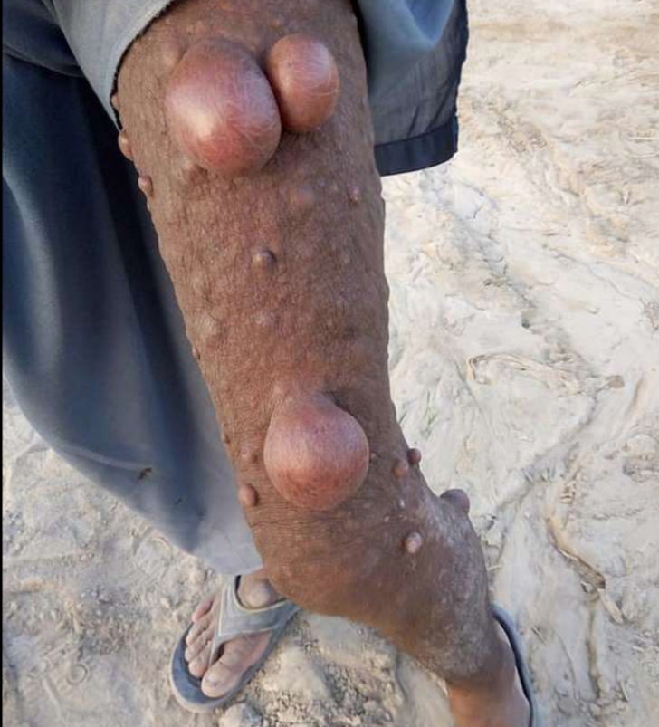 Onu gören yolunu değiştiriyor: 'Ailemi utandırmamak için...' G2